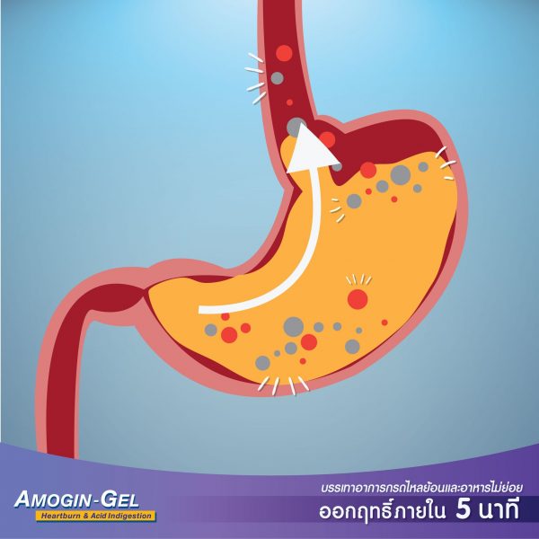 เจลลดกรดแบบซอง ลดกรดกระเพาะใน5นาที Amogin gel ฺ
