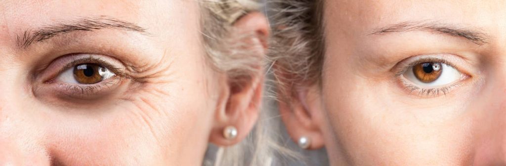 Anti Aging ครีม