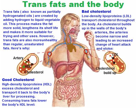 อันตรายจากไขมันทรานส์