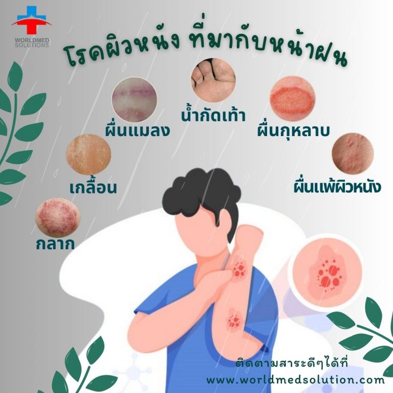 โรคผิวหนัง ที่มากับหน้าฝน
