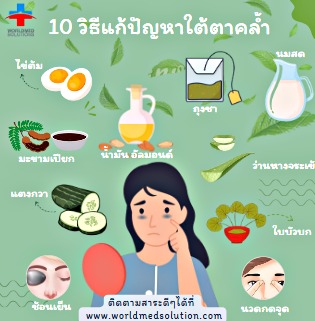 10 วิธีแก้ปัญหาใต้ตาคล้ำ