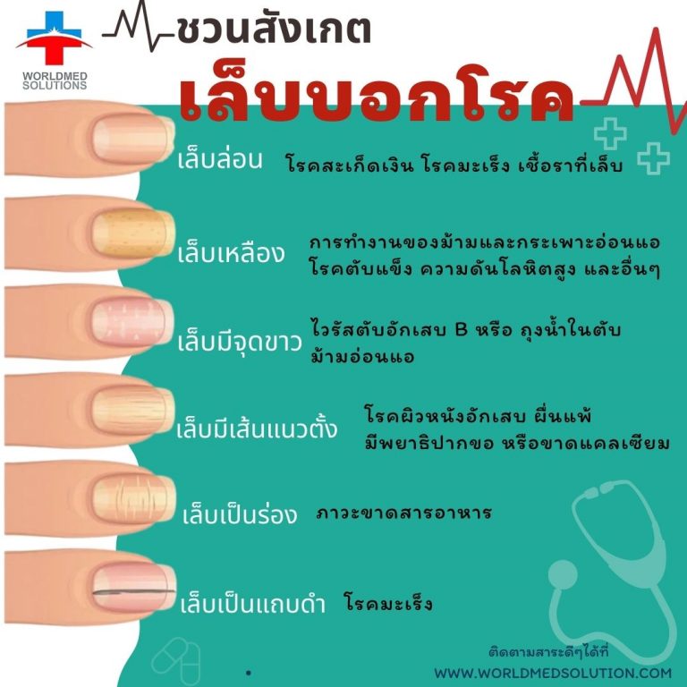 ชวนสังเกต เล็บบอกโรค