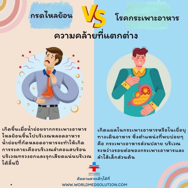 กรดไหลย้อน vs โรคกระเพาะอาหาร ความคล้ายที่แตกต่าง