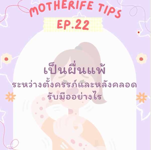 Motherife Tips EP.22 ผื่นแพ้หลังคลอด