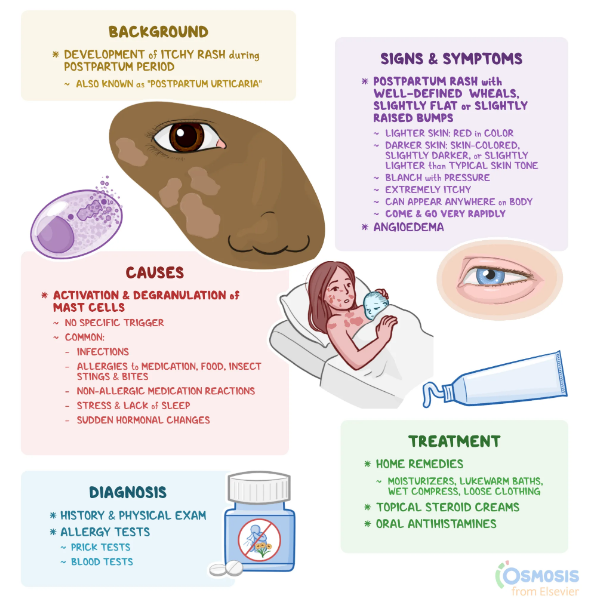 ผื่นหลังคลอด