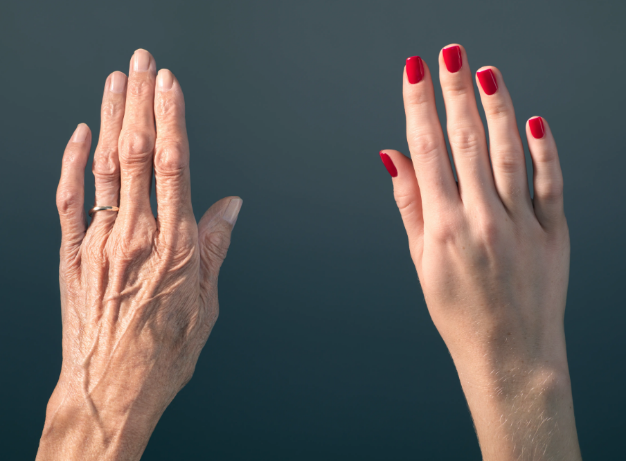 สัญญาณแก่ก่อนวัย 