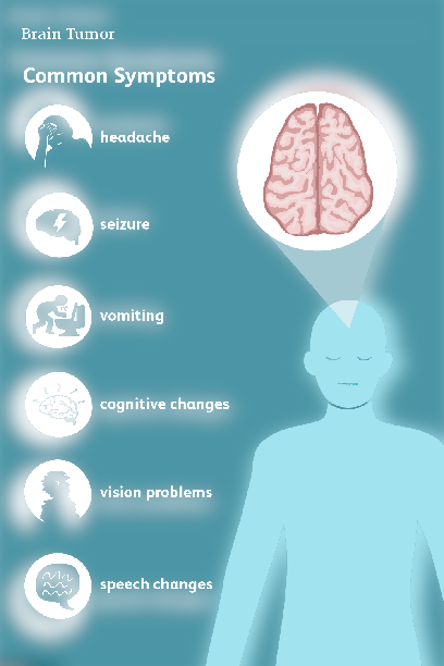 สัญญาณเตือนเนื้องอกในสมอง