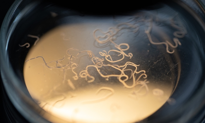 หมอเตือน ล้างผักไม่สะอาด เสี่ยงพยาธิขึ้นสมอง